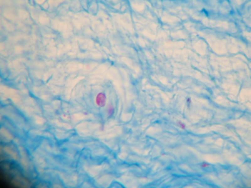 Fibrocartilage Tissue